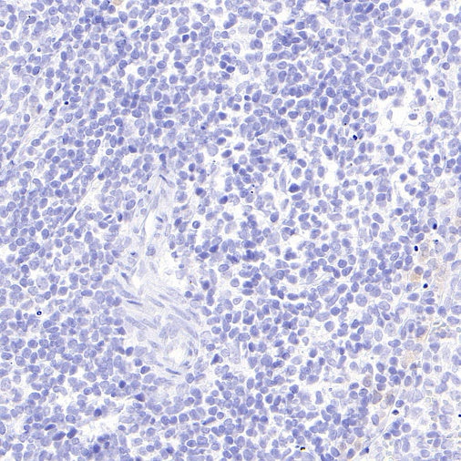 Mouse mAb IgG2b, κ Isotype Control (S-844-22)