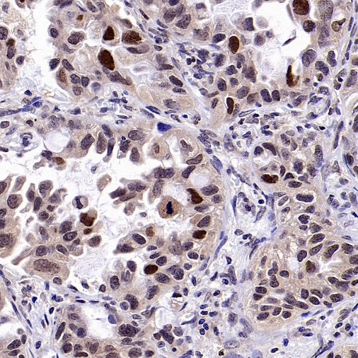 FOXM1 Recombinant Rabbit mAb (S-2529-26)