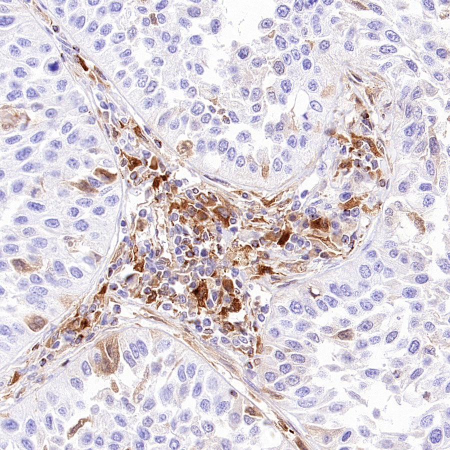 CCL18 Recombinant Rabbit mAb (S-2788-25)