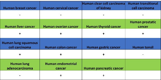 PSAP Recombinant Rabbit mAb (S-2399-11)