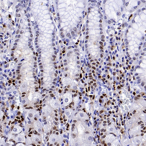 ALOX5 Recombinant Rabbit mAb (S-1980-27)