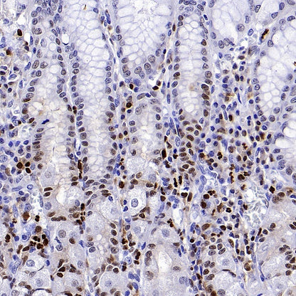 ALOX5 Recombinant Rabbit mAb (S-1980-27)