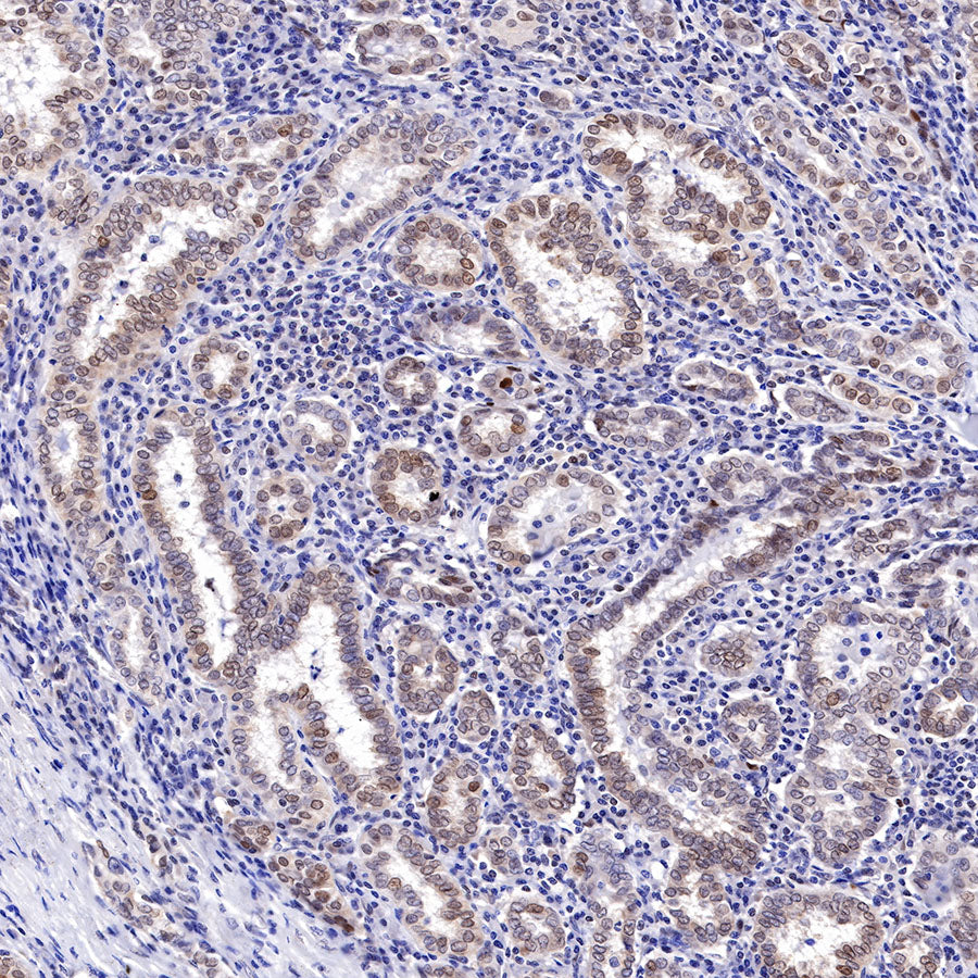 Cyclin D3 Recombinant Rabbit mAb (SDT-R124)