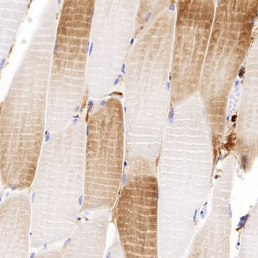 Sarcomeric Alpha Actinin Recombinant Rabbit mAb (S-1652-40)