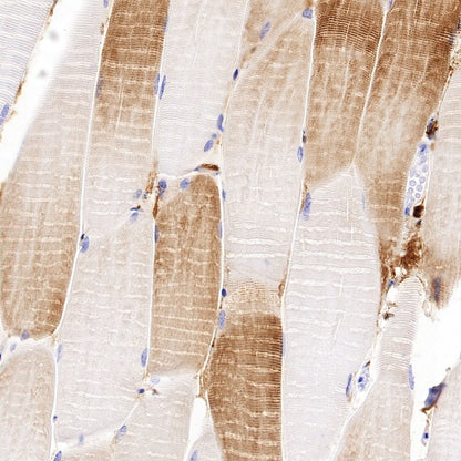 Sarcomeric Alpha Actinin Recombinant Rabbit mAb (S-1652-40)
