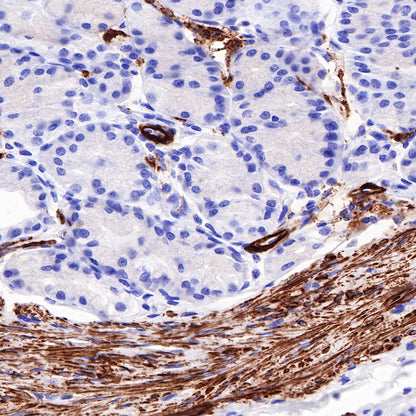 Myosin-11/SMMHC Recombinant Rabbit mAb,PBS Only (SDT-188-112)