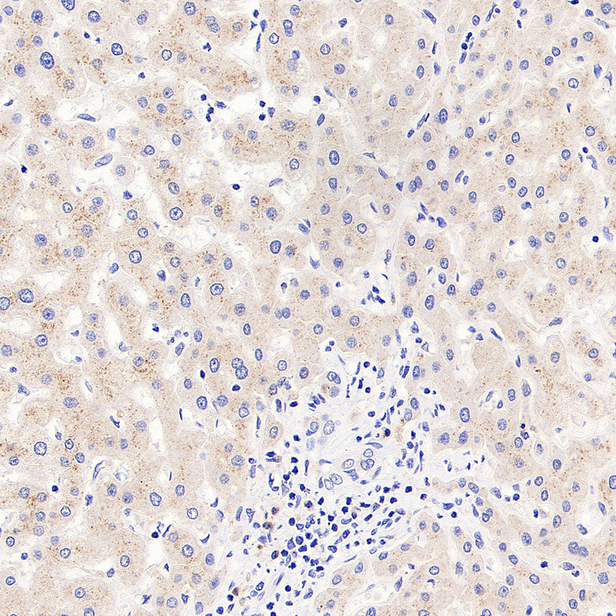 SEC24D Rabbit Polyclonal Antibody
