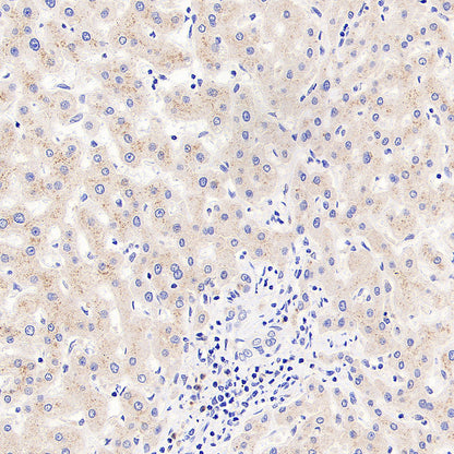 SEC24D Rabbit Polyclonal Antibody