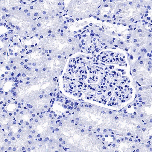 Cardiac Troponin I Recombinant Rabbit mAb (S-1352-28)