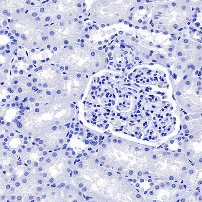 Cardiac Troponin I Recombinant Rabbit mAb (S-1352-28)