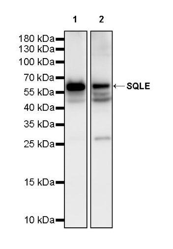 SQLE Recombinant Rabbit mAb (S-2358-207)