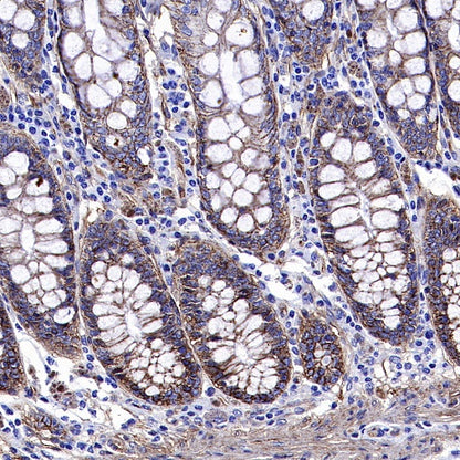 Integrin beta1/CD29 Recombinant Rabbit mAb (SDT-255-52)
