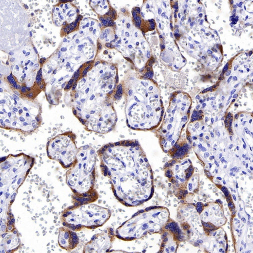 Progranulin Recombinant Rabbit mAb (S-2202-46)