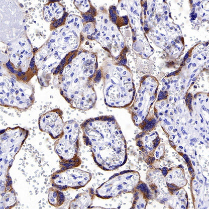 Progranulin Recombinant Rabbit mAb (S-2202-46)