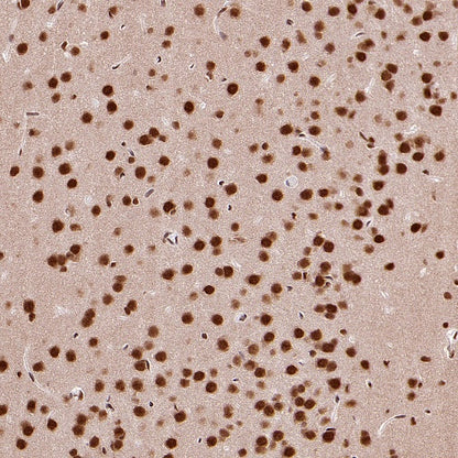 HuR/ELAVL1 Recombinant Rabbit mAb (S-2357-20)