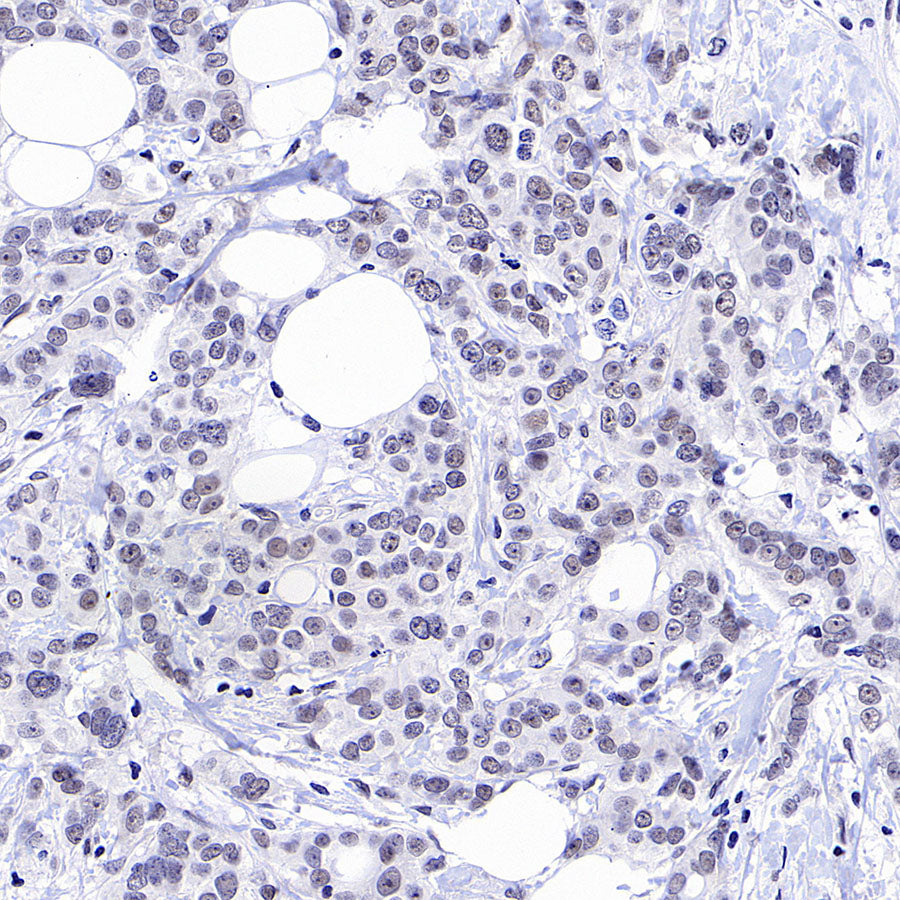 CDK7 Recombinant Rabbit mAb (S-2739-124)