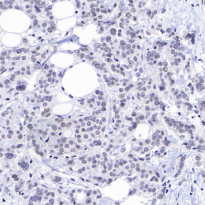 CDK7 Recombinant Rabbit mAb (S-2739-124)