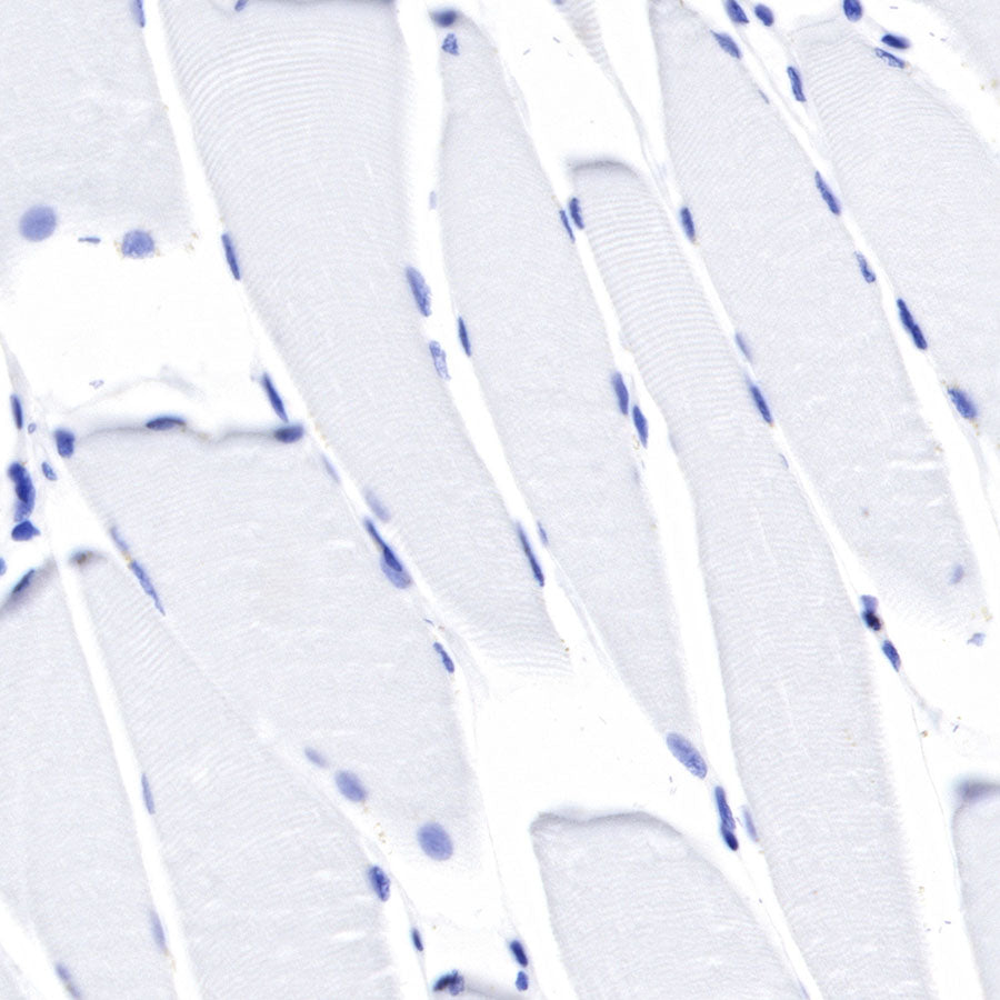 S-RMab® CD45 Recombinant Rabbit mAb,PBS Only (SDT-R035)