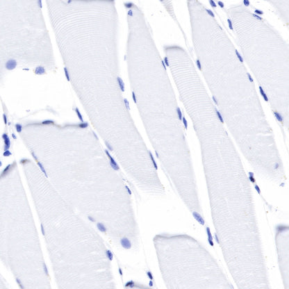 S-RMab® CD45 Recombinant Rabbit mAb,PBS Only (SDT-R035)