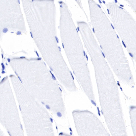 S-RMab® CD45 Recombinant Rabbit mAb,PBS Only (SDT-R035)