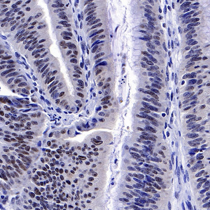 PES1 Recombinant Rat mAb (SDT-R197)