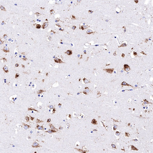 Cathepsin D Recombinant Rabbit mAb (S-R345)