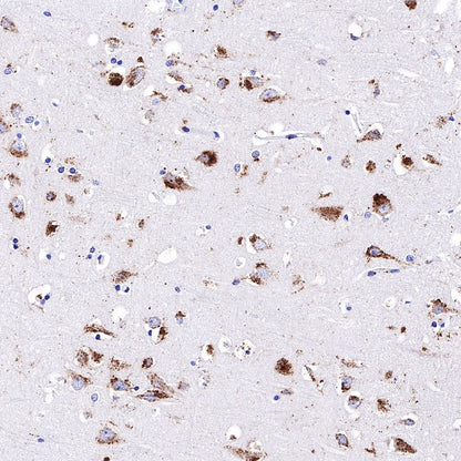 Cathepsin D Recombinant Rabbit mAb (S-R345)