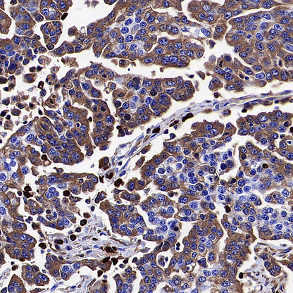 HEG1 Recombinant Rabbit mAb (S-4419-64)