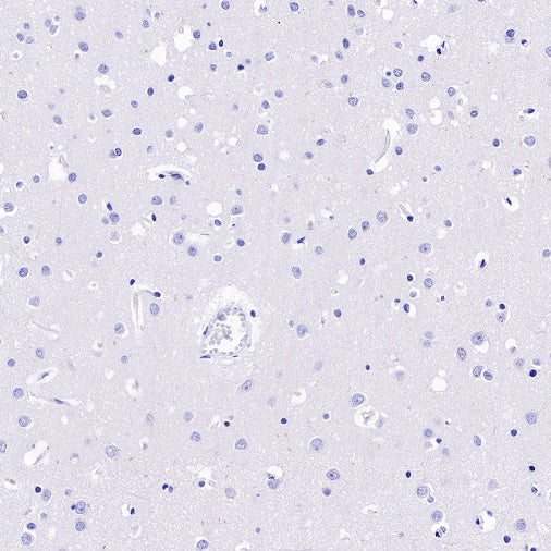 GBP5 Rabbit Polyclonal Antibody