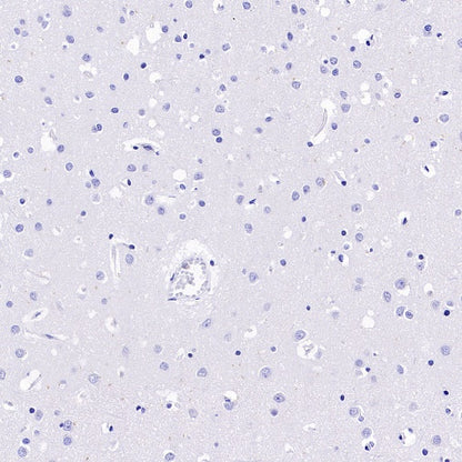 GBP5 Rabbit Polyclonal Antibody
