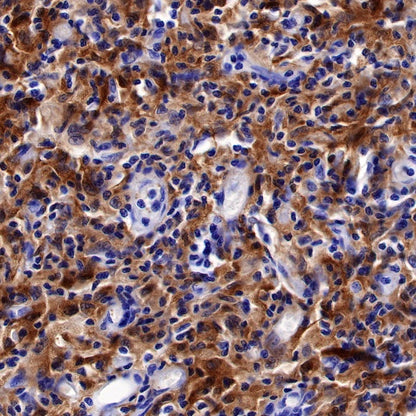 Factor XIIIa Recombinant Rabbit mAb (SDT-644-7)