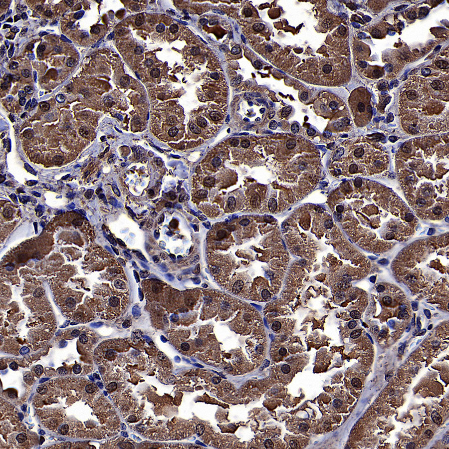 ALDOA Mouse mAb