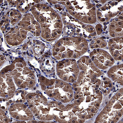 ALDOA Mouse mAb