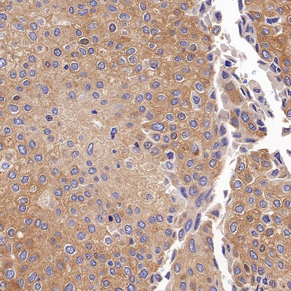 BRAF Recombinant Rabbit mAb (S-1328-60)