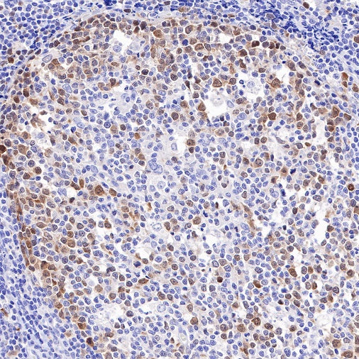 Thymidylate Synthase Recombinant Rabbit mAb (S-753-7)