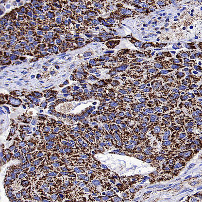 HSP60 Recombinant Mouse mAb (S-5385)
