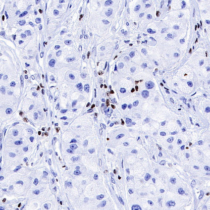 Runx3 Recombinant Rabbit mAb (S-R356)