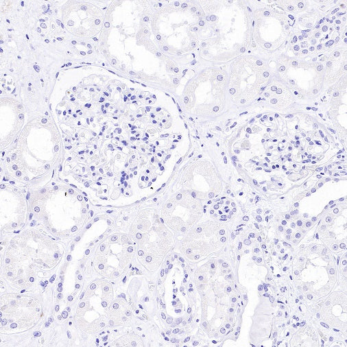 MYH7 Recombinant Rabbit mAb (SDT-2936-44)