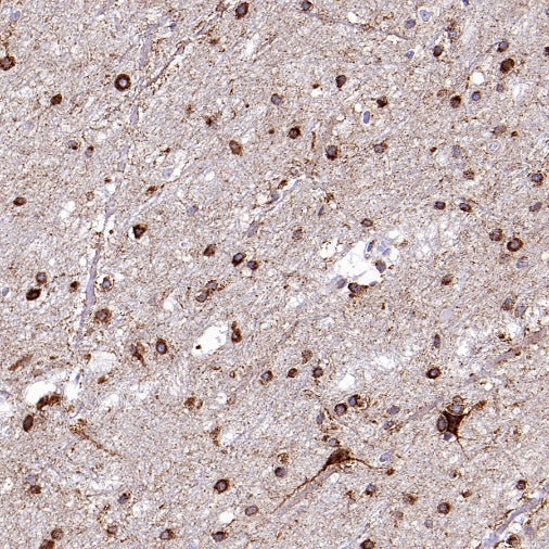 SORT1 Recombinant Rabbit mAb (S-2233-47)