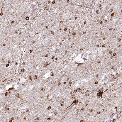 SORT1 Recombinant Rabbit mAb (S-2233-47)