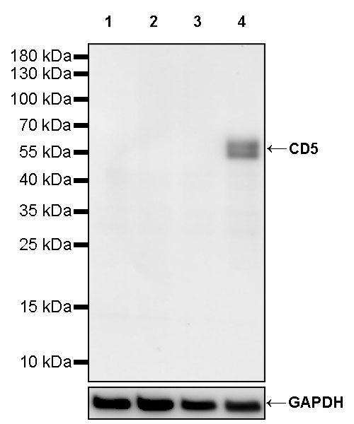 CD5 Recombinant Rabbit mAb (SDT-2570-53)