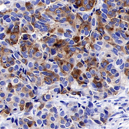 PEG10 Recombinant Rabbit mAb (SDT-442-60)