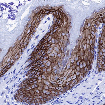 p120 Catenin Recombinant Rabbit mAb (SDT-350-75)