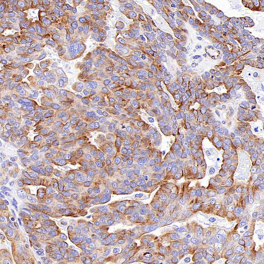 Alpha Tubulin Recombinant Mouse mAb (S-5704)