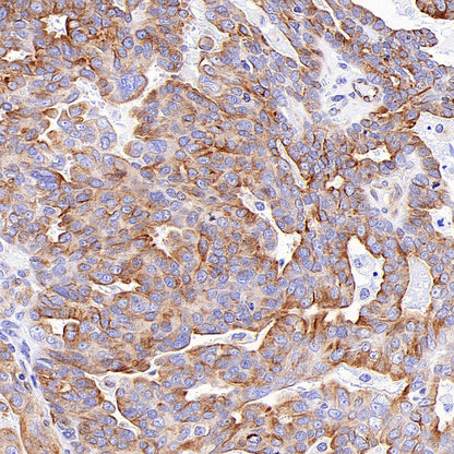 Alpha Tubulin Recombinant Mouse mAb (S-5704)
