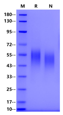 IL-2R alpha/CD25 His Tag Protein, Mouse