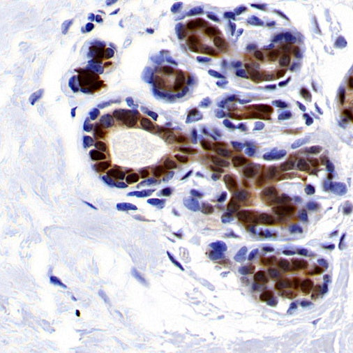 PDCD4 Rabbit polyclonal antibody