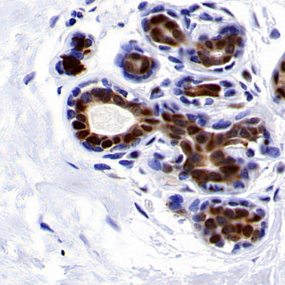 PDCD4 Rabbit polyclonal antibody