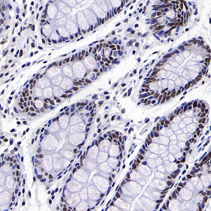 MLH1 Recombinant Mouse mAb (SDT-R702)