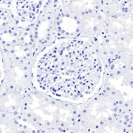FABP7 Recombinant Rabbit mAb (S-762-114)